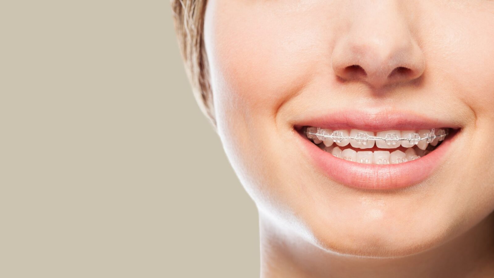 Smiling young woman with fixed braces with clear brackets