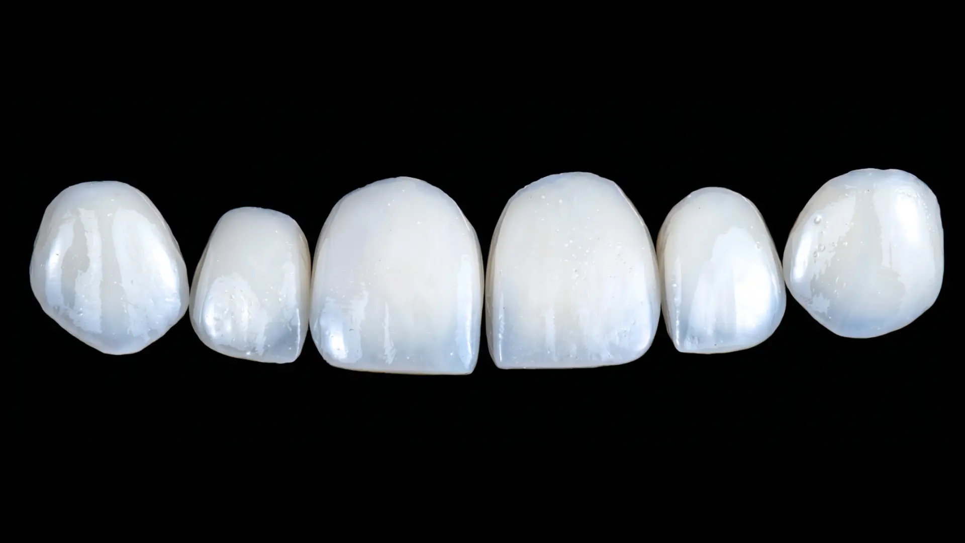 Sechs Keramik-Veneers für die oberen Frontzähne vor schwarzem Hintergrund