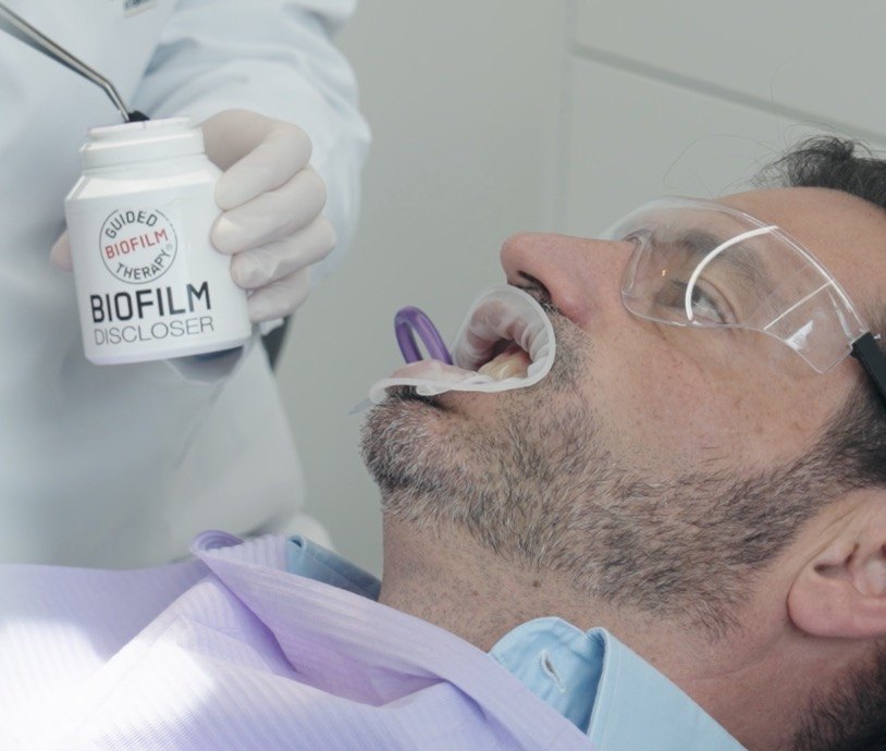 Patient mit Schutzbrille und Wangenhalter, daneben Biofilm Discloser zum Anfärben des Zahnbelags