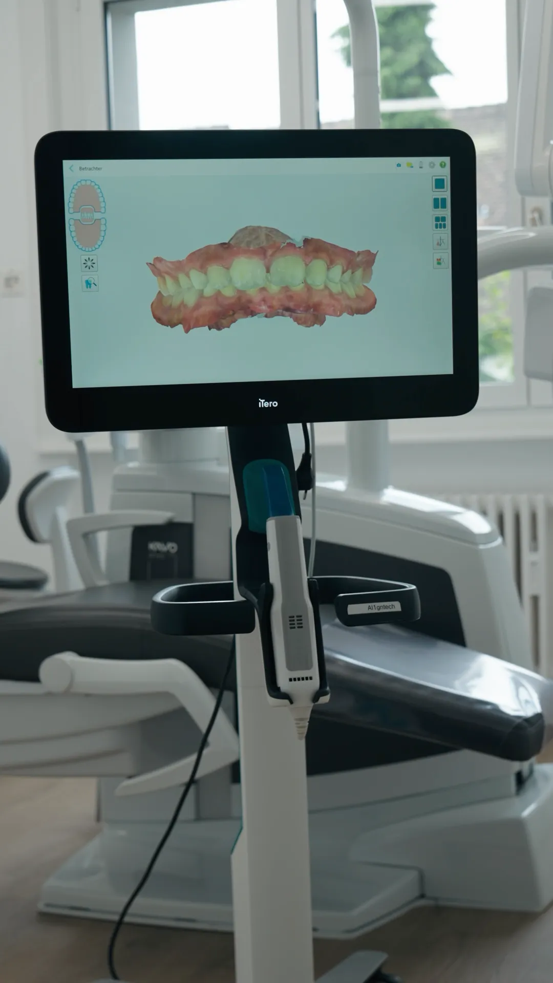 iTero intraoral scanner with a digital 3D model of the teeth on screen